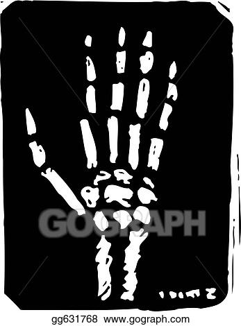 X-Ray Hand